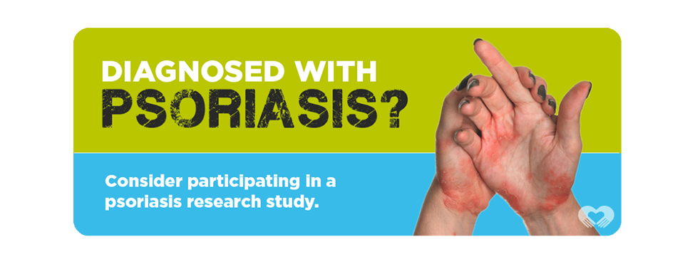 An NIH sponsored clinical trial for people with psoriasis